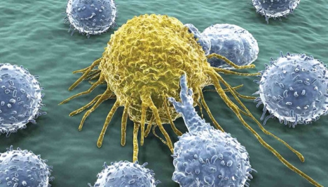 Liệu pháp tế bào miễn dịch NK - UNG THƯ KHÔNG PHẢI DẤU CHẤM HẾT