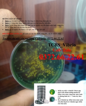Vibrio trên tcbs nuôi cấy, định lượng, đánh giá chính xác