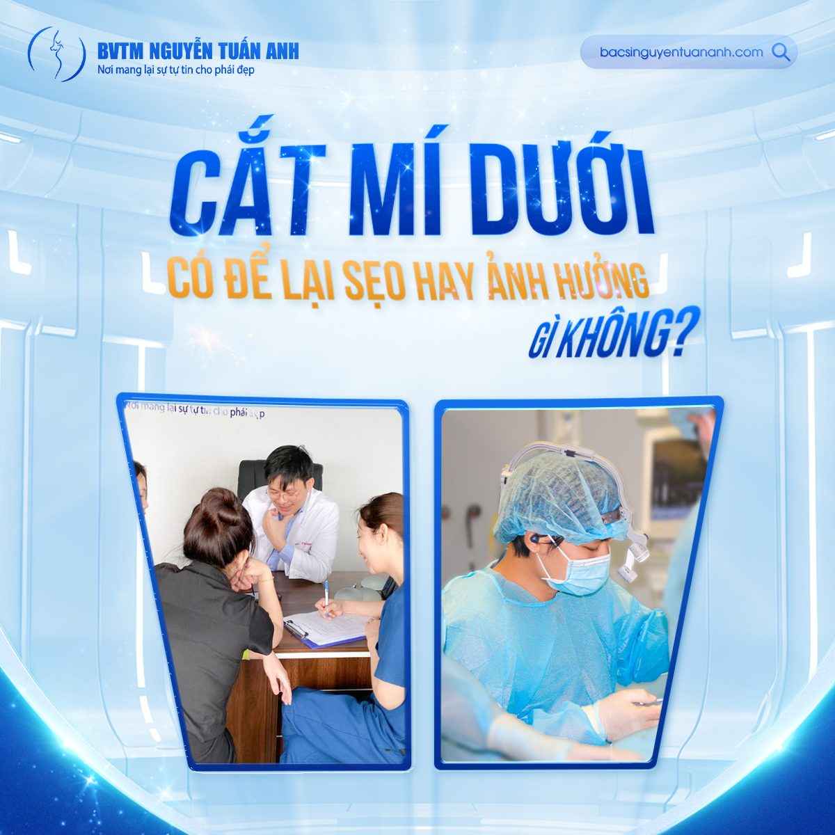 Phẫu Thuật Cắt Mí Dưới Có Để Lại Sẹo Không?