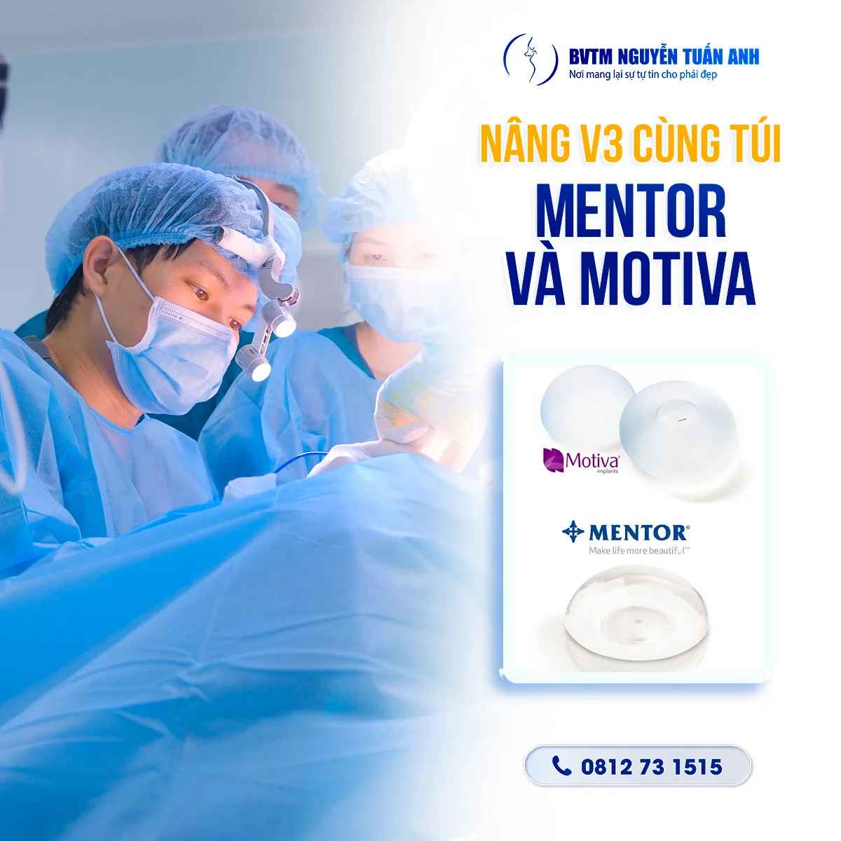 Túi Mentor Và Motiva - Loại Nào Nâng Cấp Vòng 3 Tốt Nhất